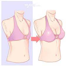breast-enlarge-patch-cara-guna-original-testimoni-cara-penggunaan